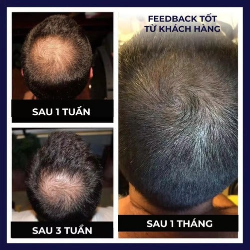 FEG HAIR GROWTH SPRAY